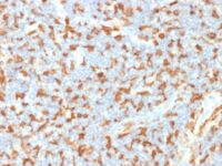 FFPE human lymph node sections stained with 100 ul anti-AIF1 (clone AIF1/1909) at 1:400. HIER epitope retrieval prior to staining was performed in 10mM Citrate, pH 6.0.